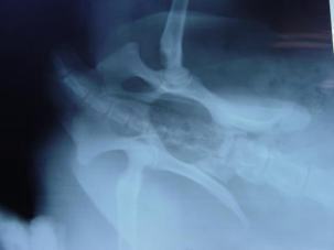 股関節のレントゲン写真